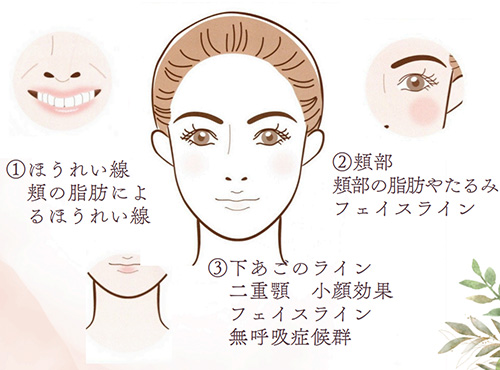 宇部市歯科医院のあいおい歯科・インプラント矯正クリニックの免疫力を上げるプラセンタ